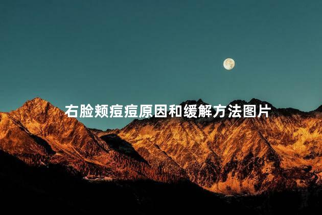 右脸颊痘痘原因和缓解方法图片